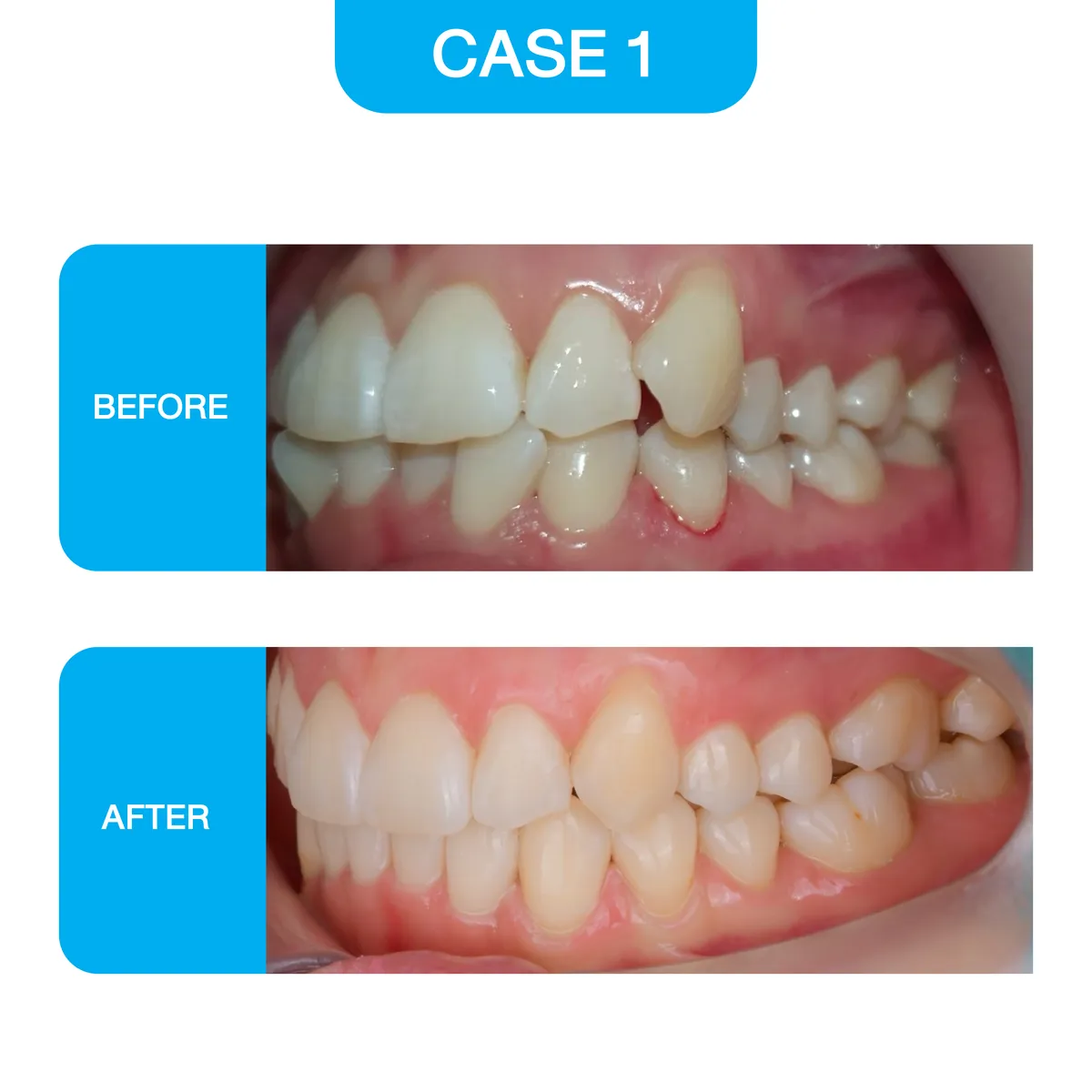 crystal-smile-2025-before-01