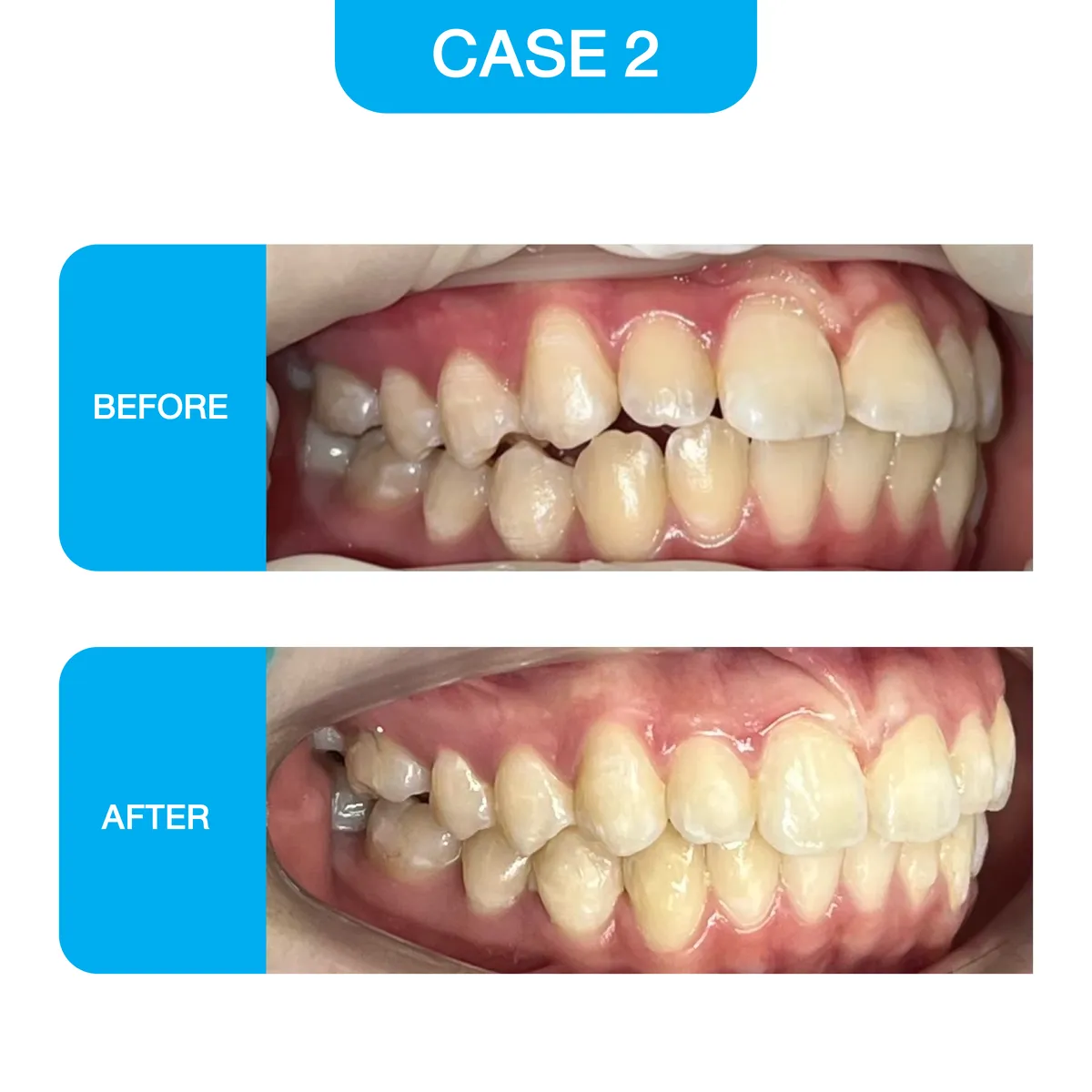 crystal-smile-2025-before-06